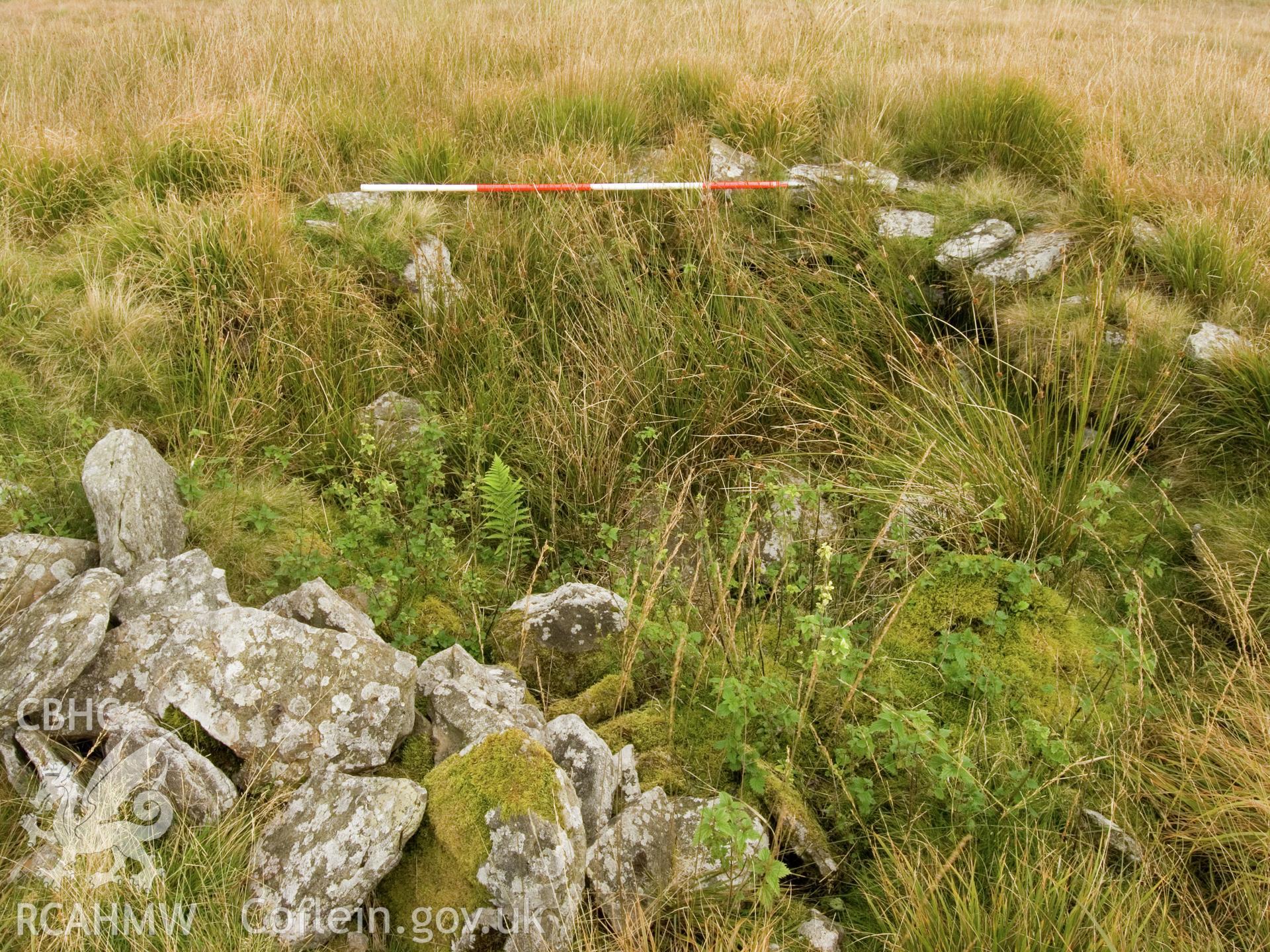 view of depression of possible cist in centre.